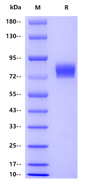 Influenza A virus H1N1-HA(A/Nagasaki/HA-4/2009 H1N1), His tag