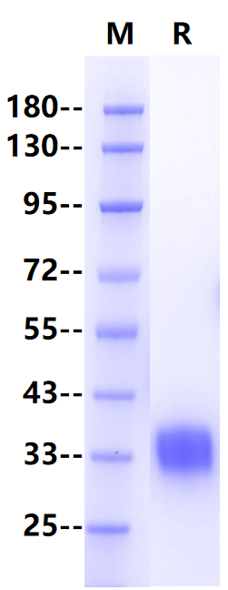 Adiponectin, His Tag, Human