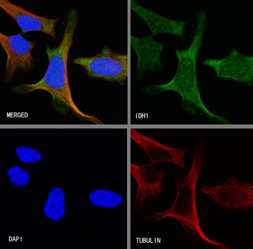 IDH1 Recombinant Rabbit mAb (S-792-16)