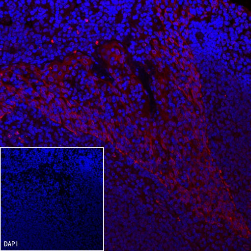 PD-L1 Recombinant Rabbit mAb (Alexa Fluor® 555 Conjugate) (SDT-119-16)