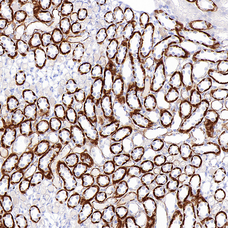 ROBO2 Recombinant Rabbit mAb (S-4563-43)