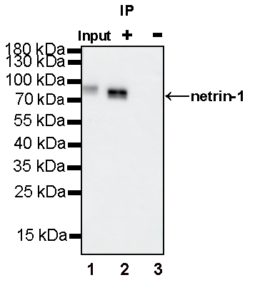Netrin-1 Recombinant Rabbit mAb (S-1510-104)