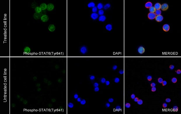 Phospho-Stat6 (Tyr641) Recombinant Rabbit mAb (S-1440-135)