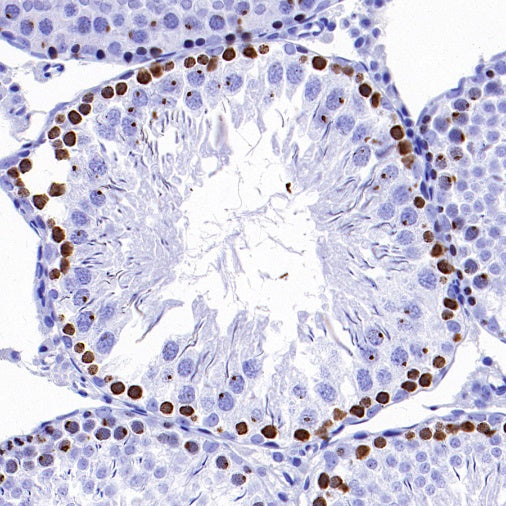 Phospho-Histone H2A.X (Ser139) Recombinant Rabbit mAb (S-1368-15)