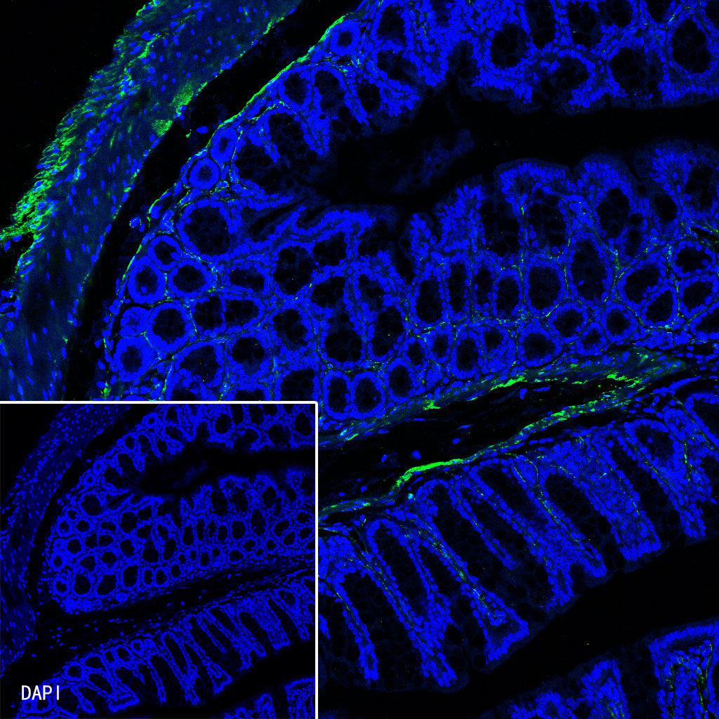 Myosin-11/SMMHC Recombinant Rabbit mAb (SDT-188-112)