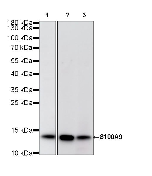 S100A9 Recombinant Rabbit mAb