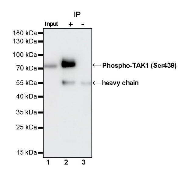 Phospho-TAK1 (Ser439) Recombinant Rabbit mAb (S-1136-46)