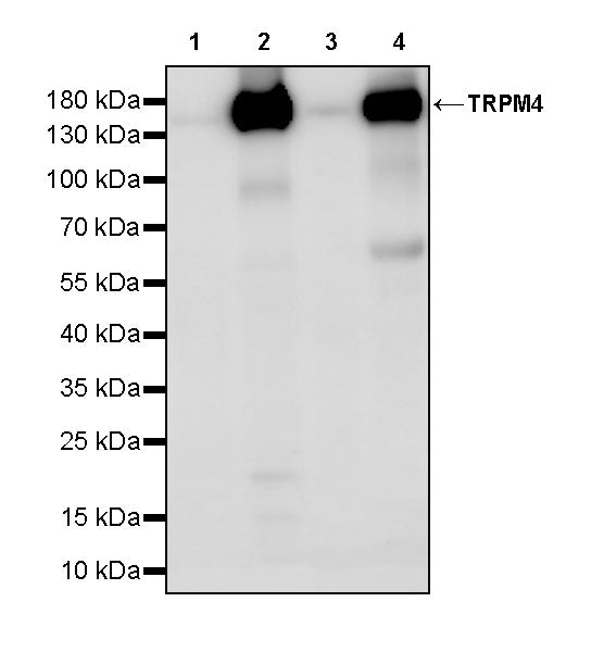 TRPM4 Recombinant Rabbit mAb (S-3948-2)