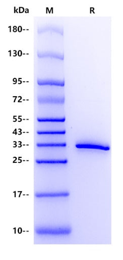 Human IGFBP-2 Protein, His Tag