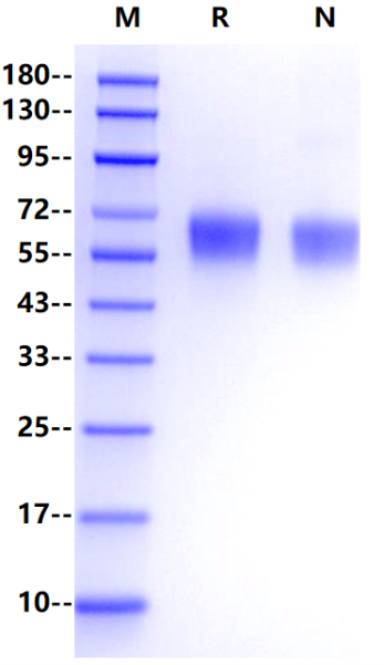 GM-CSFR α His Tag Protein, Human