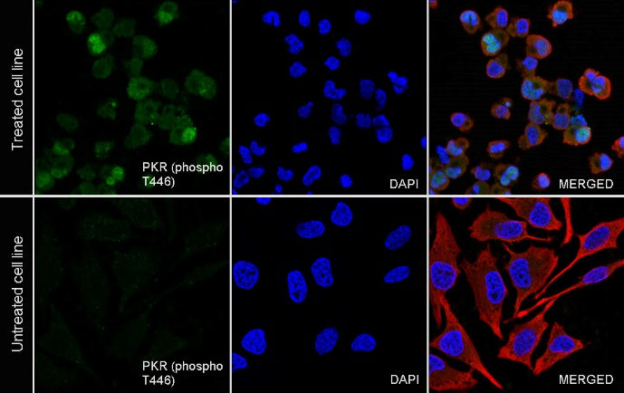 Phospho-PKR (Thr446) Recombinant Rabbit mAb (S-771-17)