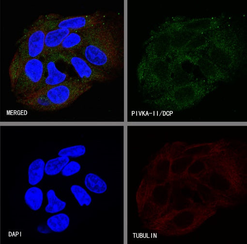 Prothrombin Recombinant Rabbit mAb (S-R348)