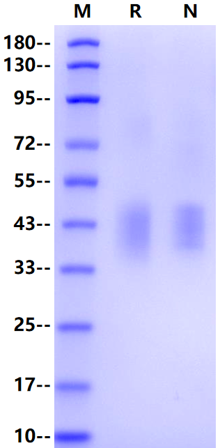 FcRL1/CD307a His Tag Protein, Human