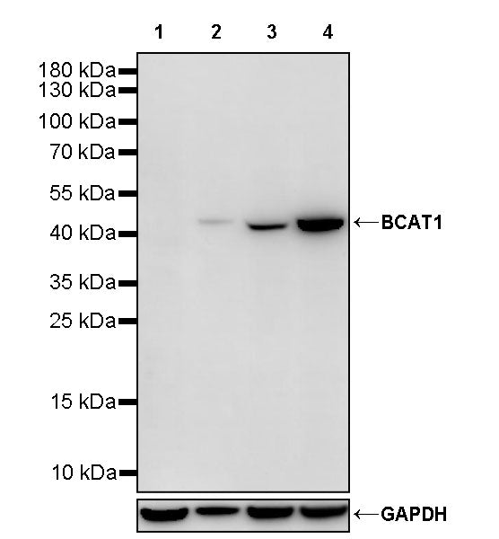 BCAT1 Recombinant Rabbit mAb (S-4159-9)