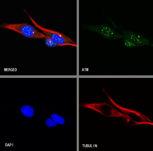 ATM Recombinant Rabbit mAb (S-2178-4)
