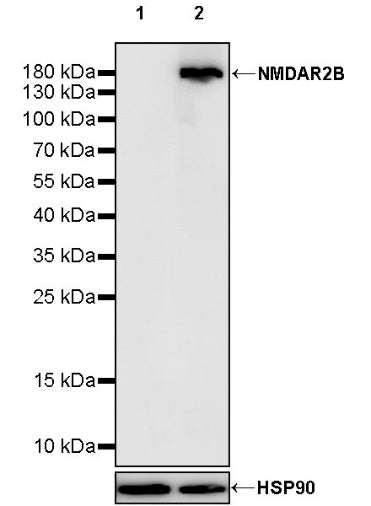 NMDAR2B Recombinant Rabbit mAb (S-1864-37)