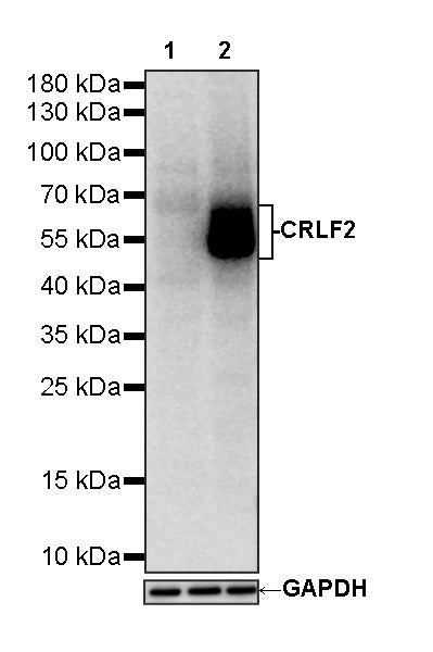 CRLF2 Recombinant Rabbit mAb (S-4014-6)