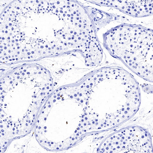 S-RMab® CGA/HCG-α Recombinant Rabbit mAb (SDT-643-61)