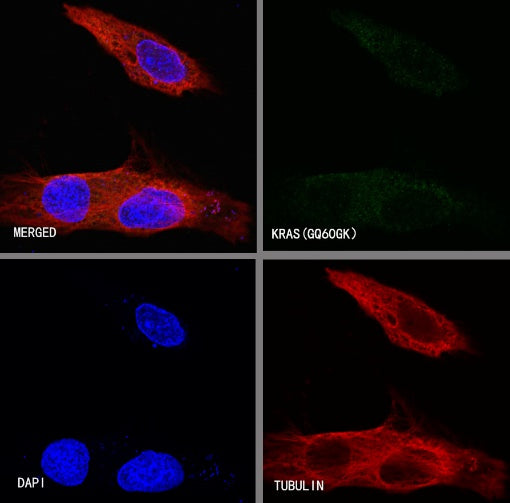 KRAS (mutated GQ60GK) + (mutated Q61K) Recombinant Rabbit mAb (S-604-4)