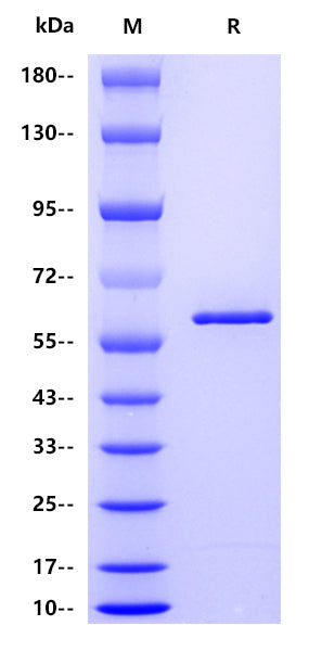 Influenza A virus NP(A/Puerto Rico/8/1934 H1N1), His tag