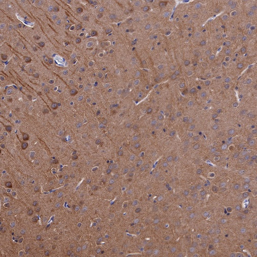 LC3B Recombinant Rabbit mAb (S-477-89)