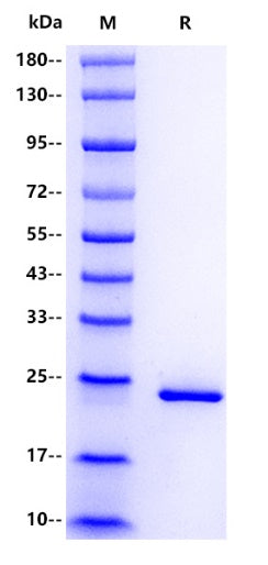 Rat GH Protein, His tag