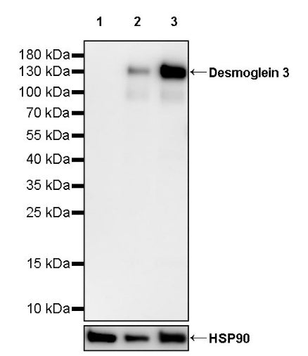 Desmoglein 3 Rabbit Polyclonal Antibody