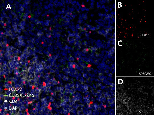 CD25/IL-2Rα, FOXP3, CD4 Antibody Panel
