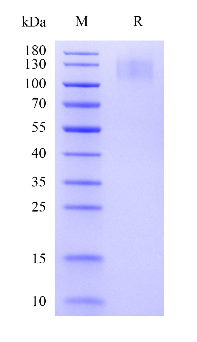 Human CEA Protein, His Tag