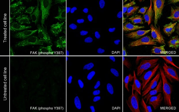 Phospho-FAK (Tyr397) Rabbit Polyclonal Antibody