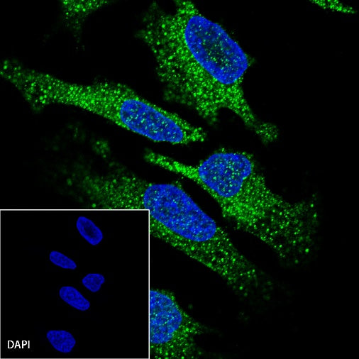 MAGE-A1 Recombinant Rabbit mAb (S-R183)
