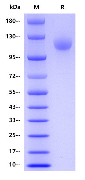 Human CD42b, His tag
