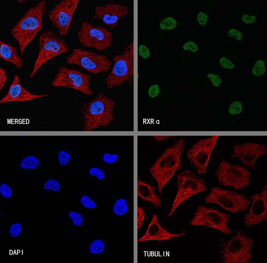 RXRα Recombinant Rabbit mAb