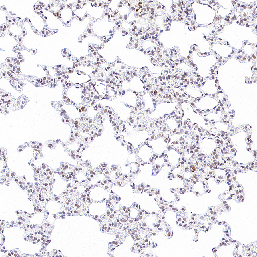 Phospho-STAT1 (Ser727) Recombinant Rabbit mAb