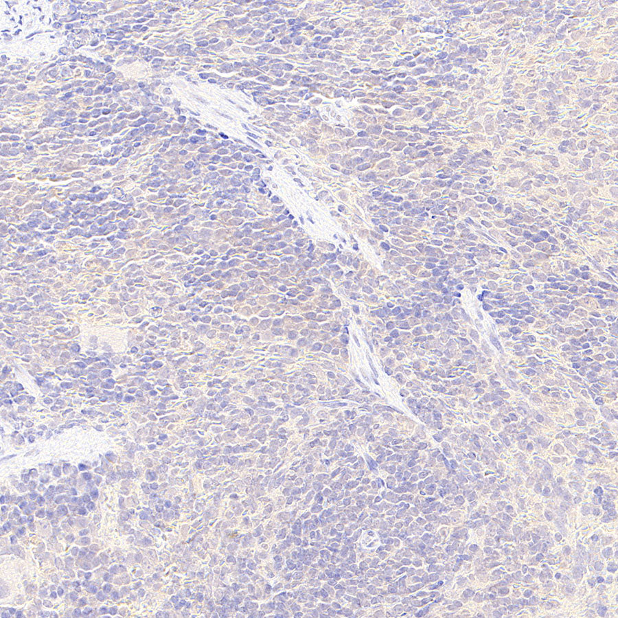 GABA A Receptor alpha 5/GABRA5 Recombinant Rabbit mAb (S-6030)