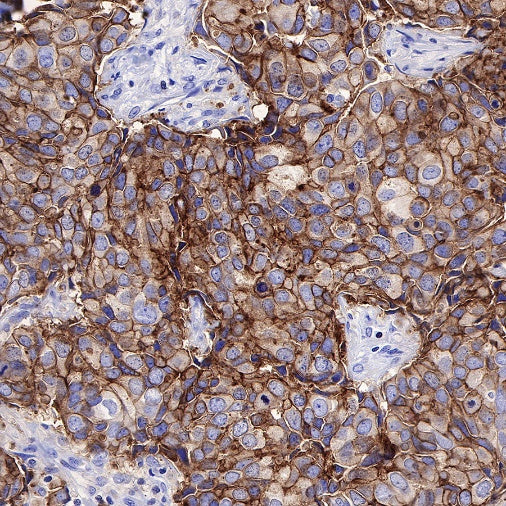CD66a/CEACAM1 Recombinant Rabbit mAb (S-678-53)