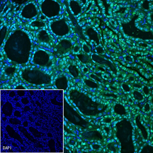 TTF-1 Recombinant Rabbit mAb (Alexa Fluor® 488 Conjugate) (SDT-R097)
