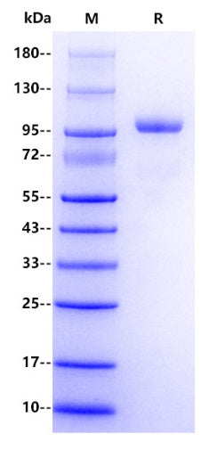 Human CFB/Complement factor B Protein, His Tag