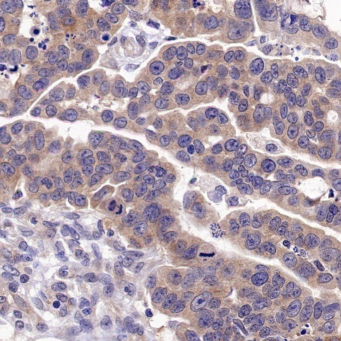 IDE Recombinant Rabbit mAb (S-1051-61)