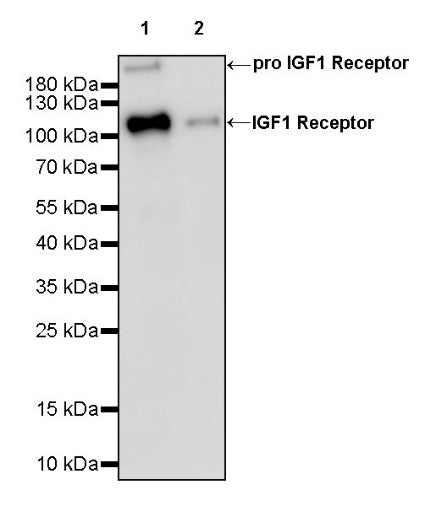 IGF1 Receptor Recombinant Rabbit mAb (S-1617-146)