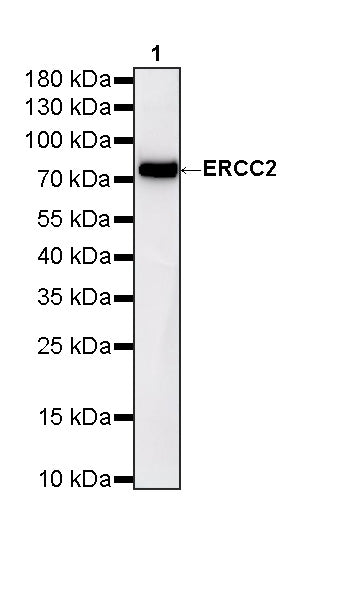 ERCC2 Recombinant Rabbit mAb (S-4403-3)