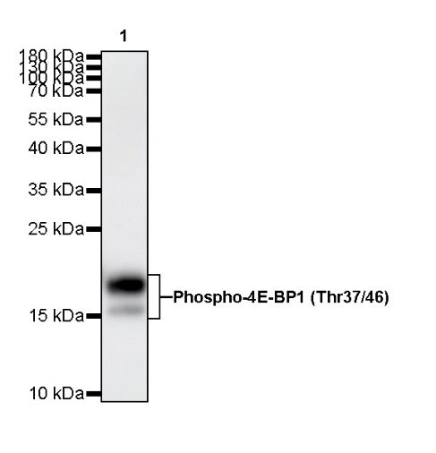 Phospho-4E-BP1 (Thr37/46) Recombinant Rabbit mAb (S-744-46)