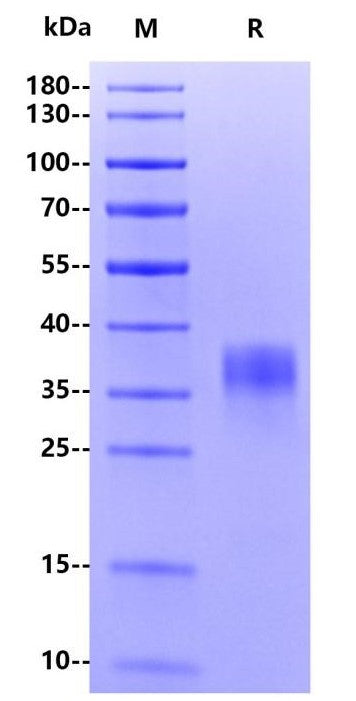 Human PD-L1, His Tag