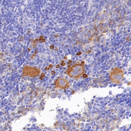 5-HT (Serotonin) Transporter Recombinant Rabbit mAb (S-1332-21)