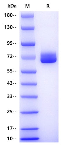 ALPI His Tag Protein, Human
