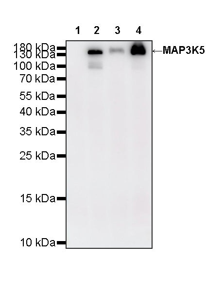 MAP3K5 Recombinant Rabbit mAb (S-4566-31)