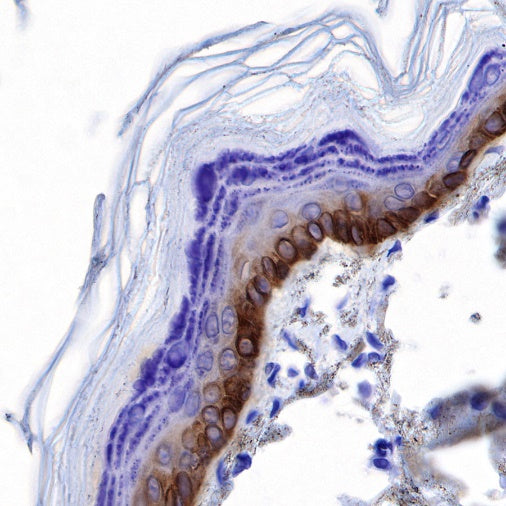 CK-13 Recombinant Rabbit mAb (SDT-641-41)