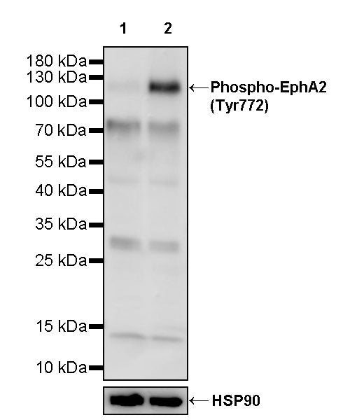 Phospho-EphA2 (Tyr772) Recombinant Rabbit mAb (S-3525-94)