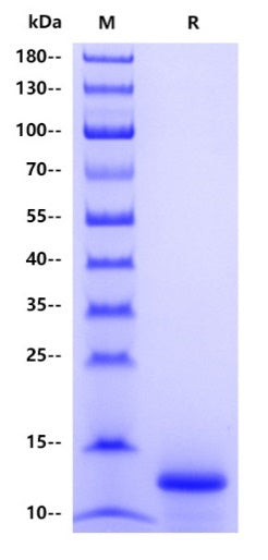 Human FDX1 Protein, His Tag