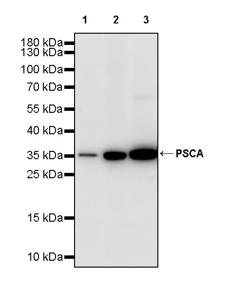 PSCA Recombinant Rabbit mAb (S-3475-72)